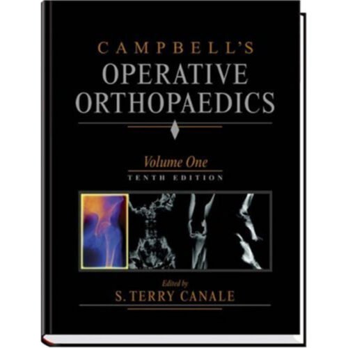 Campbell's Operative Orthopedics (4 Volume Set)